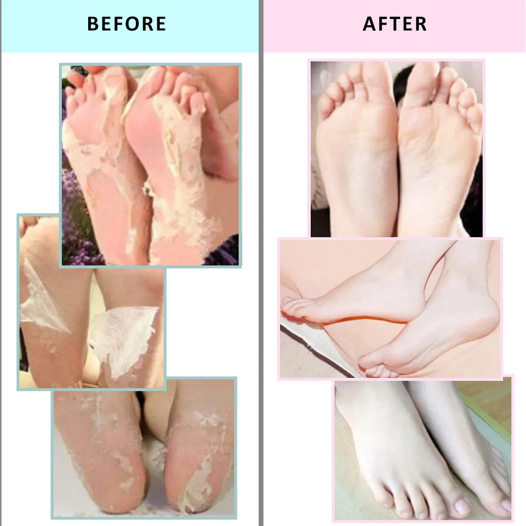 [Clearance Sale] Essential Wonders I Peel Good! Foot Peeling Mask - Expiration: JUN 6, 2025