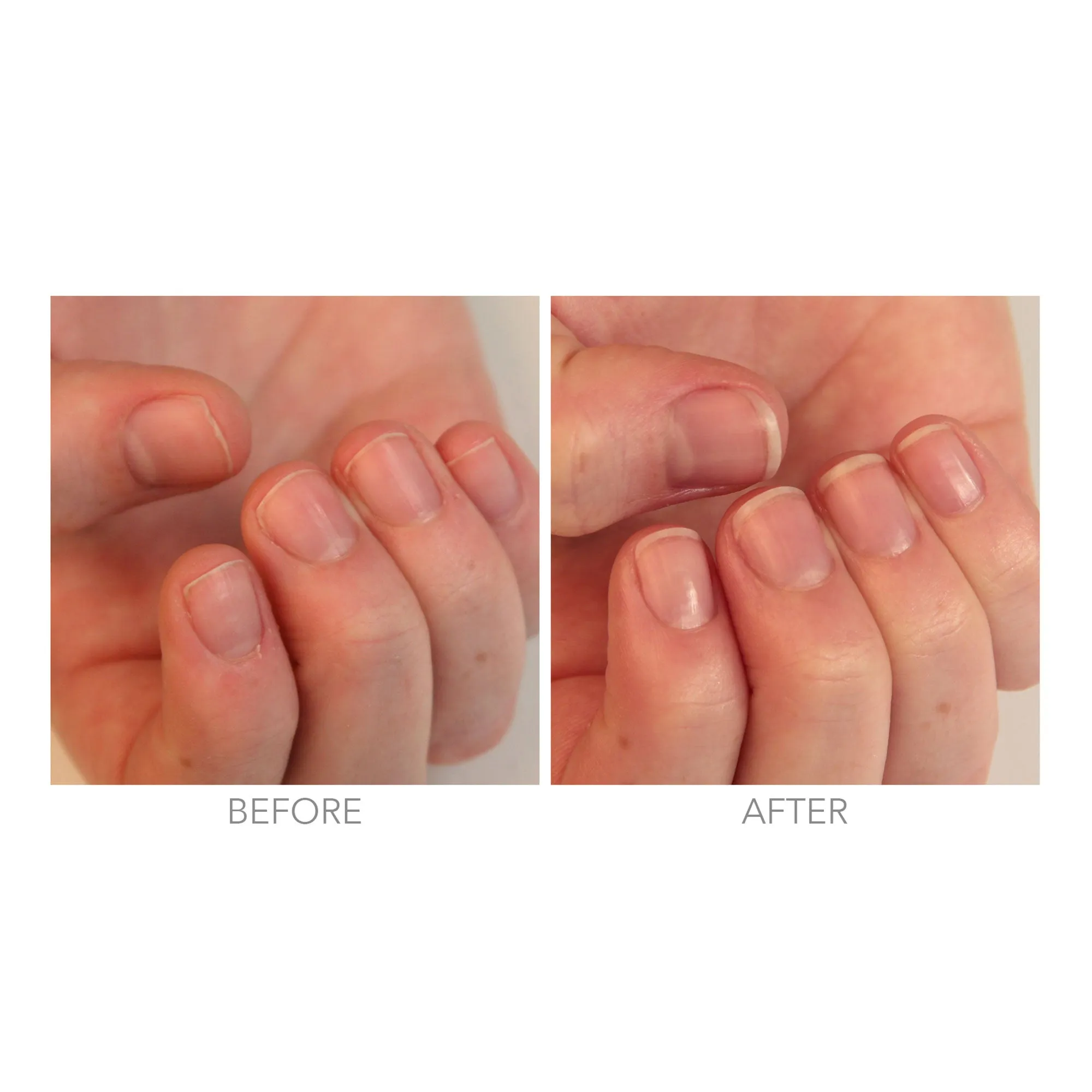 Restorative Nail Cream (Professional)